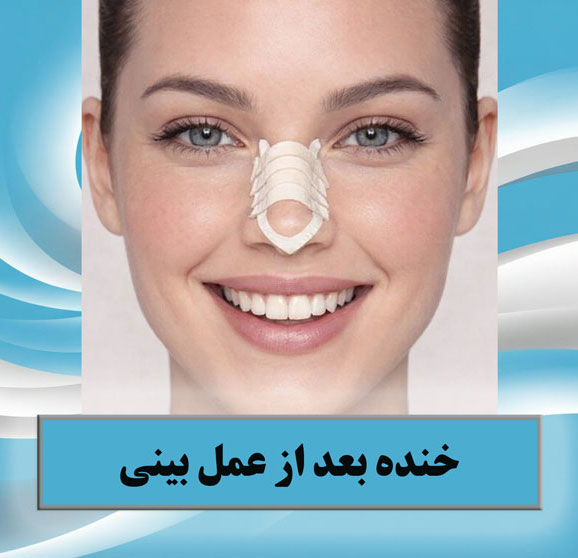 خنده بعد از عمل