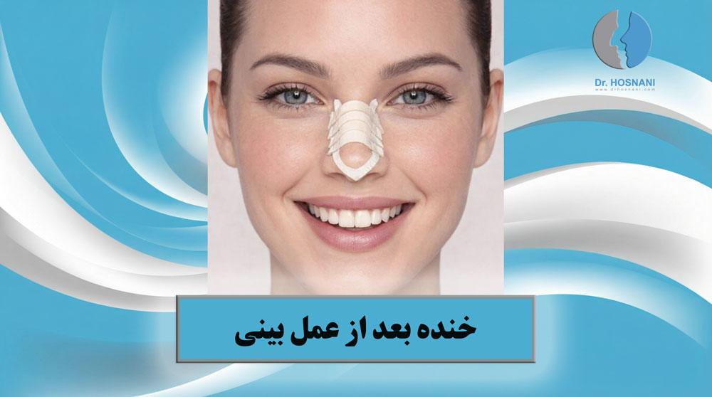 خنده و قهقهه