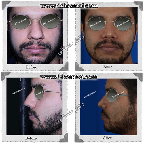 meaty natural nose gallery og