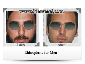 men