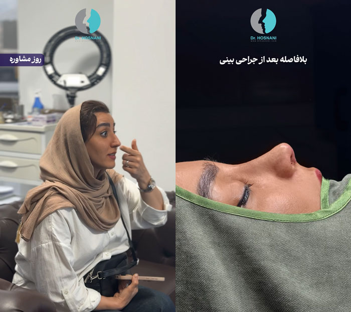قبل عمل در روز مشاوره vs بلافاصله بعد از عمل