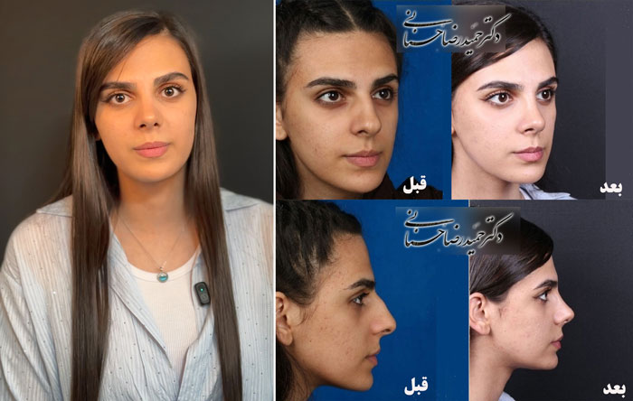 نگار سه ماه بعد از جراحی