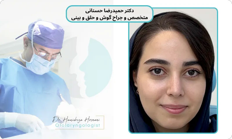 اصلاح پره های بینی