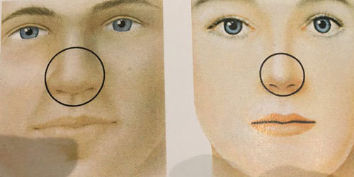 nasal tip of men and women