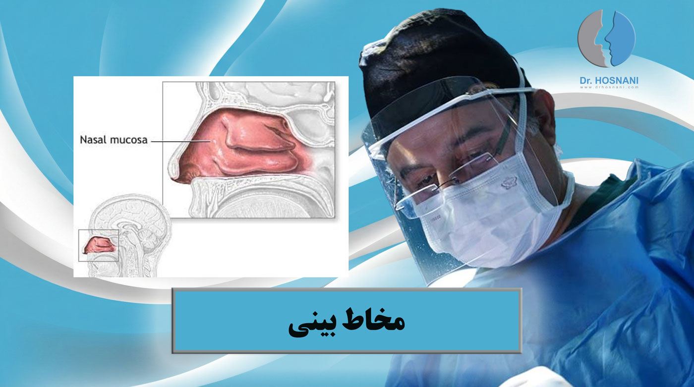 مخاط یا موکوزای بینی