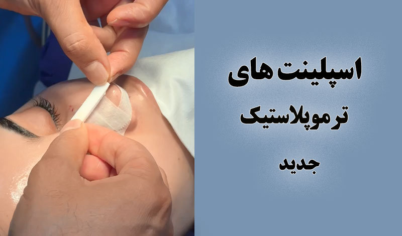 آشنایی با اسپلینت های ترموپلاستیک جدید