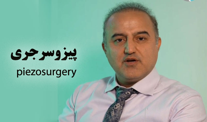 نظر دکتر حسنانی در مورد پیزوسرجری
