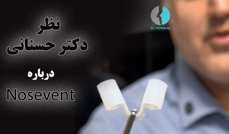 نوزونت nose vent