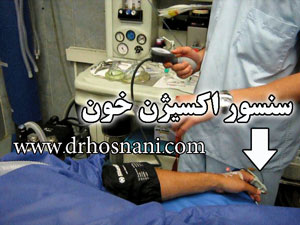 oxygen sensor