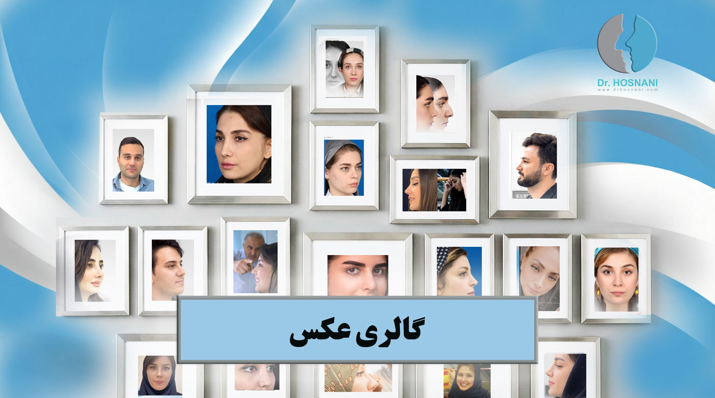 photo gallery drhosnani