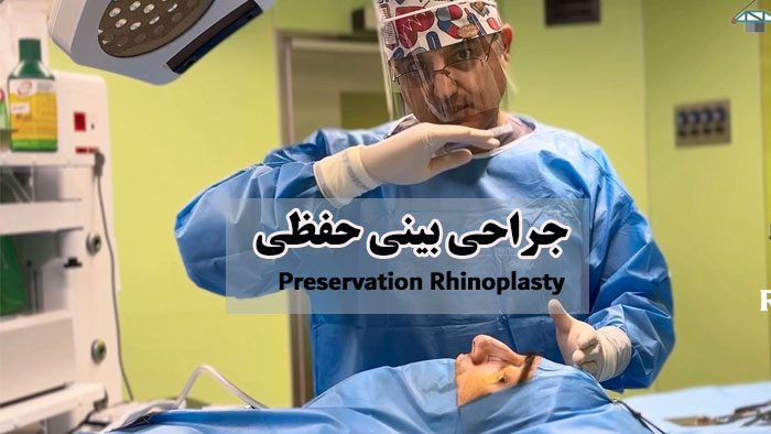 preservation rhinoplasty doctor hosnani explains