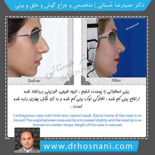 profile view gallery og
