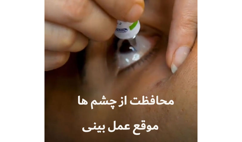محافظت از چشم ها هنگام عمل جراحی بینی