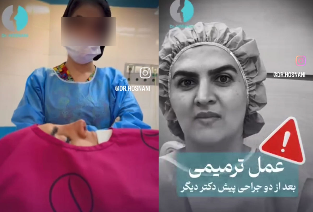 جراحی ترمیمی بینی: اصلاح مشکلات زیبایی بینی بعد از دو جراحی ناموفق