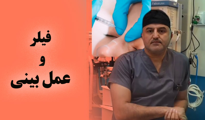جراحی بینی برای کسی که فیلر زده!