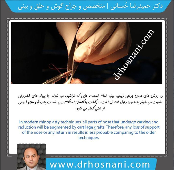 تقویت غضروفی