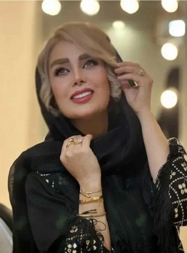 از دلشوره تا دلگرمی: ماجرای جراحی بینی خانم صبا راد مجری محبوب تلویزیون با دکتر حسنانی
