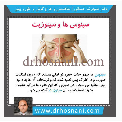 sinus and sinusitis