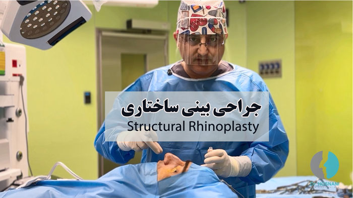 structural rhinoplasty technic shown doctor view
