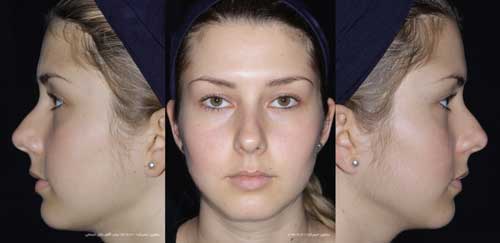 Esmeralda\’s Pre-operative Photos