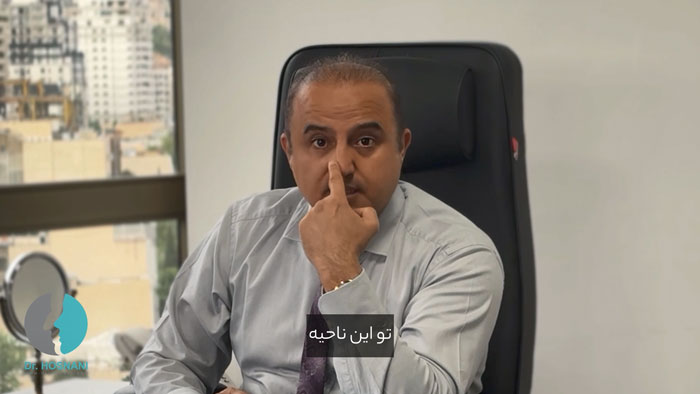 ناحیه سوپراتیپ بینی