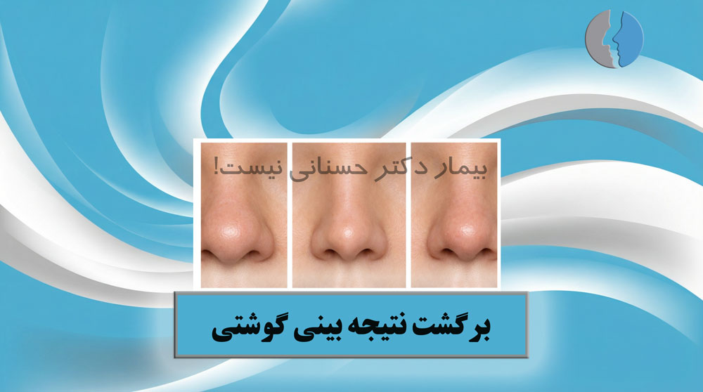 thick skin nose relapse