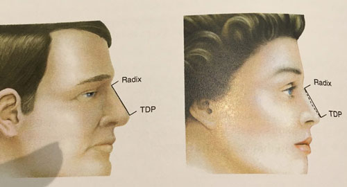 tip defining point