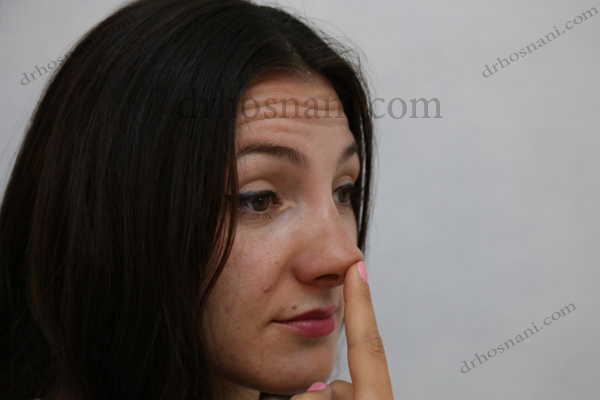 بالا بردن نوک بینی