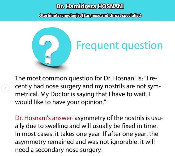 uveven nostrils faq en